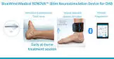 Greatcare Non-invasive Tibial Nerve Stimultion