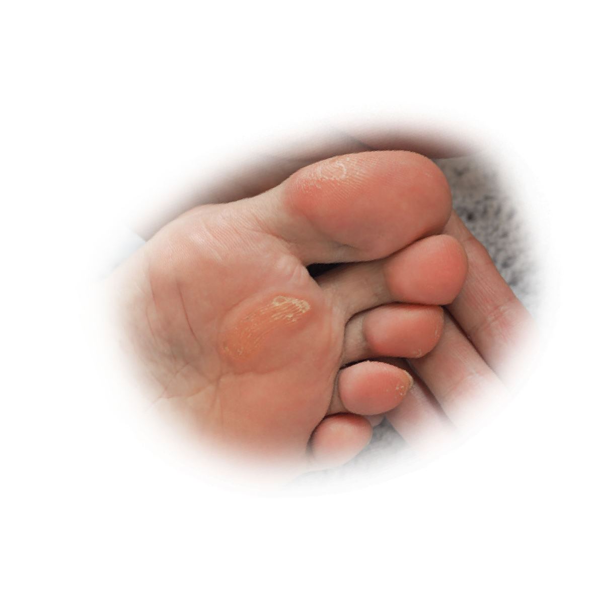 Pharmaplast كيور إيد® Callus لصقات طبية